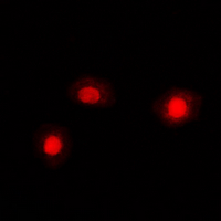 CFL1 / Cofilin Antibody - Immunofluorescent analysis of Cofilin staining in K562 cells. Formalin-fixed cells were permeabilized with 0.1% Triton X-100 in TBS for 5-10 minutes and blocked with 3% BSA-PBS for 30 minutes at room temperature. Cells were probed with the primary antibody in 3% BSA-PBS and incubated overnight at 4 ??C in a humidified chamber. Cells were washed with PBST and incubated with a DyLight 594-conjugated secondary antibody (red) in PBS at room temperature in the dark. DAPI was used to stain the cell nuclei (blue).