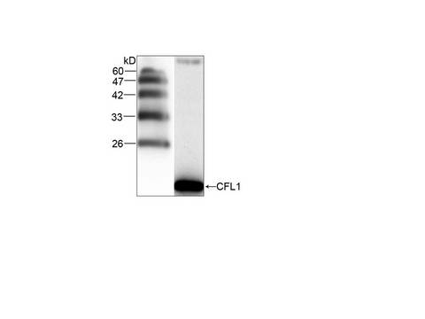 CFL1 / Cofilin Antibody
