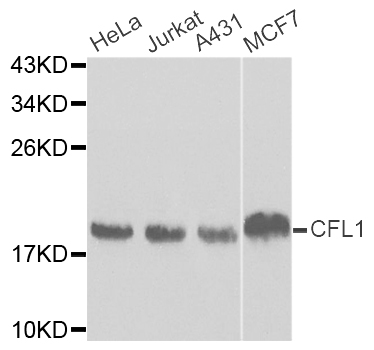 CFL1 / Cofilin Antibody - Western blot analysis of extracts of various cell lines.