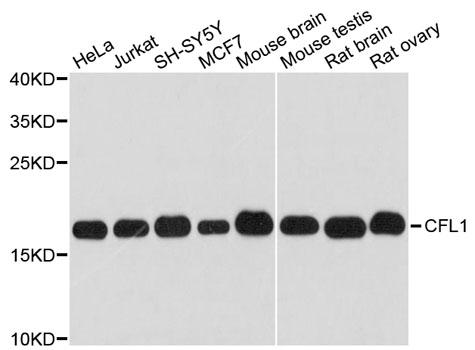 CFL1 / Cofilin Antibody - Western blot analysis of extracts of various cell lines, using CFL1 antibody at 1:3000 dilution. The secondary antibody used was an HRP Goat Anti-Rabbit IgG (H+L) at 1:10000 dilution. Lysates were loaded 25ug per lane and 3% nonfat dry milk in TBST was used for blocking. An ECL Kit was used for detection and the exposure time was 1s.