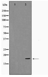 CFL1 / Cofilin Antibody - Western blot of Jurkat cell lysate using Cofilin Antibody
