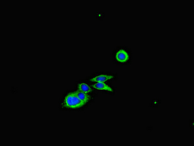 CFL1 / Cofilin Antibody - Immunofluorescent analysis of HepG2 cells diluted at 1:100 and Alexa Fluor 488-congugated AffiniPure Goat Anti-Rabbit IgG(H+L)
