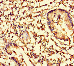 CFL1 / Cofilin Antibody - Immunohistochemistry of paraffin-embedded human appendix tissue at dilution of 1:100