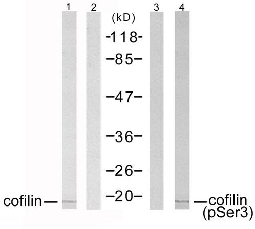 CFL1 / Cofilin Antibody - Western blot analysis of extracts from COLO 205 cells using cofilin (Ab-1022) antibody (Line 1 and 2) and cofilin (phospho-Ser3) antibody (Line 3 and 4).