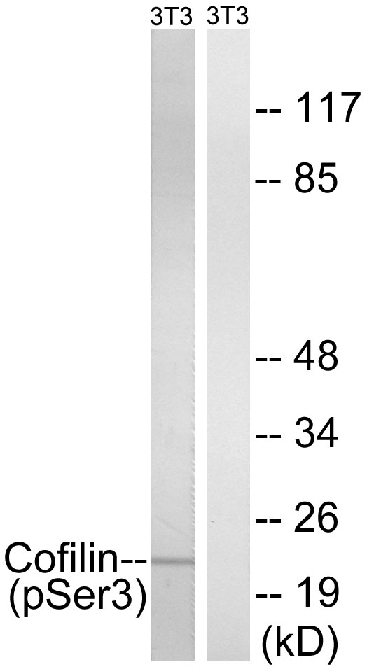 CFL1 / Cofilin Antibody - Western blot analysis of lysates from NIH/3T3 cells treated with paclitaxel 1uM 24hours, using Cofilin (Phospho-Ser3) Antibody. The lane on the right is blocked with the phospho peptide.