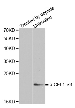 CFL1 / Cofilin Antibody - Western blot analysis of extracts from COLO205 cells.