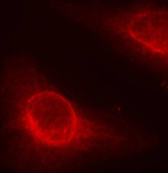 CFL1 / Cofilin Antibody - Immunofluorescence staining of methanol-fixed Hela cells.