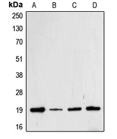 CFL1 / Cofilin Antibody - Western blot analysis of Cofilin (pS3) expression in Jurkat (A); HeLa (B); MCF7 (C); A431 (D) whole cell lysates.