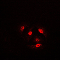 CFL1 / Cofilin Antibody - Immunofluorescent analysis of Cofilin (pS3) staining in HeLa cells. Formalin-fixed cells were permeabilized with 0.1% Triton X-100 in TBS for 5-10 minutes and blocked with 3% BSA-PBS for 30 minutes at room temperature. Cells were probed with the primary antibody in 3% BSA-PBS and incubated overnight at 4 C in a humidified chamber. Cells were washed with PBST and incubated with a DyLight 594-conjugated secondary antibody (red) in PBS at room temperature in the dark. DAPI was used to stain the cell nuclei (blue).