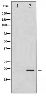 CFL1 / Cofilin Antibody - Western blot of Cofilin phosphorylation expression in COLO205 whole cell lysates,The lane on the left is treated with the antigen-specific peptide.