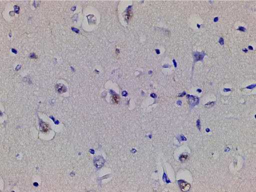 CFL1 / Cofilin Antibody - 1:200 staining human brain tissue by IHC-P. The tissue was formaldehyde fixed and a heat mediated antigen retrieval step in citrate buffer was performed. The tissue was then blocked and incubated with the antibody for 1.5 hours at 22°C. An HRP conjugated goat anti-rabbit antibody was used as the secondary.