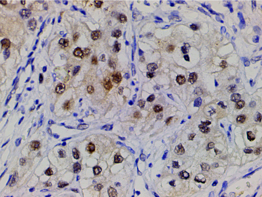 CFL1 / Cofilin Antibody - 1:200 staining human spleen tissue by IHC-P. The tissue was formaldehyde fixed and a heat mediated antigen retrieval step in citrate buffer was performed. The tissue was then blocked and incubated with the antibody for 1.5 hours at 22°C. An HRP conjugated goat anti-rabbit antibody was used as the secondary.