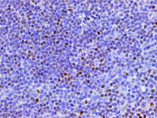 CFL1 / Cofilin Antibody - 1:200 staining human appendix tissue by IHC-P. The tissue was formaldehyde fixed and a heat mediated antigen retrieval step in citrate buffer was performed. The tissue was then blocked and incubated with the antibody for 1.5 hours at 22°C. An HRP conjugated goat anti-rabbit antibody was used as the secondary.