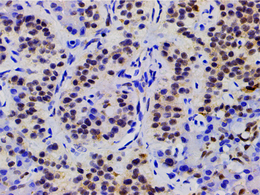 CFL1 / Cofilin Antibody - 1:200 staining human duodenum tissue by IHC-P. The tissue was formaldehyde fixed and a heat mediated antigen retrieval step in citrate buffer was performed. The tissue was then blocked and incubated with the antibody for 1.5 hours at 22°C. An HRP conjugated goat anti-rabbit antibody was used as the secondary.