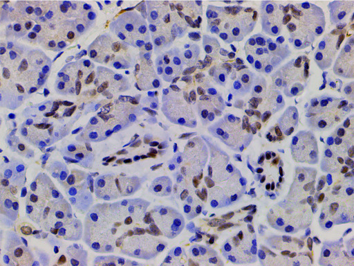 CFL1 / Cofilin Antibody - 1:200 staining human pancreas tissue by IHC-P. The tissue was formaldehyde fixed and a heat mediated antigen retrieval step in citrate buffer was performed. The tissue was then blocked and incubated with the antibody for 1.5 hours at 22°C. An HRP conjugated goat anti-rabbit antibody was used as the secondary.
