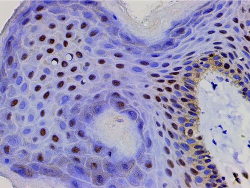 CFL1 / Cofilin Antibody - 1:200 staining human skin tissue by IHC-P. The tissue was formaldehyde fixed and a heat mediated antigen retrieval step in citrate buffer was performed. The tissue was then blocked and incubated with the antibody for 1.5 hours at 22°C. An HRP conjugated goat anti-rabbit antibody was used as the secondary.