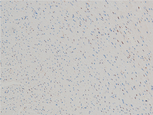 CFL1 / Cofilin Antibody - 1:100 staining rat heart tissue by IHC-P. The tissue was formaldehyde fixed and a heat mediated antigen retrieval step in citrate buffer was performed. The tissue was then blocked and incubated with the antibody for 1.5 hours at 22°C. An HRP conjugated goat anti-rabbit antibody was used as the secondary.