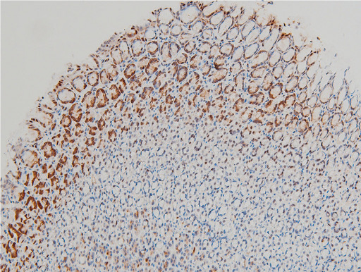 CFL1 / Cofilin Antibody - 1:100 staining rat gastric tissue by IHC-P. The tissue was formaldehyde fixed and a heat mediated antigen retrieval step in citrate buffer was performed. The tissue was then blocked and incubated with the antibody for 1.5 hours at 22°C. An HRP conjugated goat anti-rabbit antibody was used as the secondary.