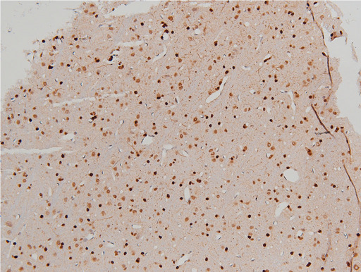 CFL1 / Cofilin Antibody - 1:100 staining rat brain tissue by IHC-P. The tissue was formaldehyde fixed and a heat mediated antigen retrieval step in citrate buffer was performed. The tissue was then blocked and incubated with the antibody for 1.5 hours at 22°C. An HRP conjugated goat anti-rabbit antibody was used as the secondary.