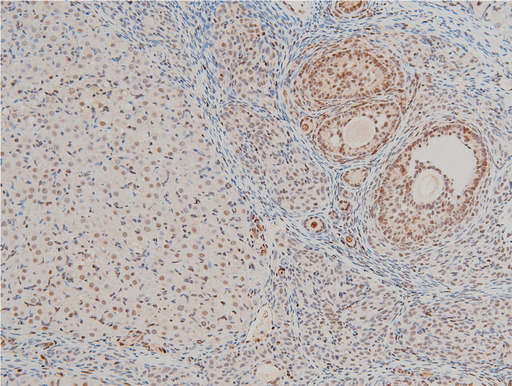 CFL1 / Cofilin Antibody - 1:100 staining rat ovarian tissue by IHC-P. The tissue was formaldehyde fixed and a heat mediated antigen retrieval step in citrate buffer was performed. The tissue was then blocked and incubated with the antibody for 1.5 hours at 22°C. An HRP conjugated goat anti-rabbit antibody was used as the secondary.