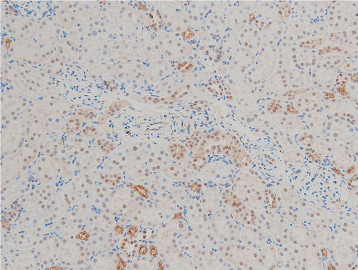 CFL1 / Cofilin Antibody - 1:100 staining rat kidney tissue by IHC-P. The tissue was formaldehyde fixed and a heat mediated antigen retrieval step in citrate buffer was performed. The tissue was then blocked and incubated with the antibody for 1.5 hours at 22°C. An HRP conjugated goat anti-rabbit antibody was used as the secondary.
