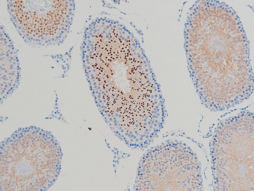 CFL1 / Cofilin Antibody - 1:100 staining rat testis tissue by IHC-P. The tissue was formaldehyde fixed and a heat mediated antigen retrieval step in citrate buffer was performed. The tissue was then blocked and incubated with the antibody for 1.5 hours at 22°C. An HRP conjugated goat anti-rabbit antibody was used as the secondary.