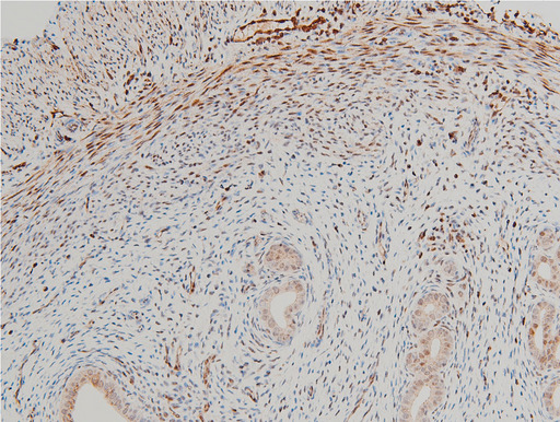 CFL1 / Cofilin Antibody - 1:100 staining rat uterine tissue by IHC-P. The tissue was formaldehyde fixed and a heat mediated antigen retrieval step in citrate buffer was performed. The tissue was then blocked and incubated with the antibody for 1.5 hours at 22°C. An HRP conjugated goat anti-rabbit antibody was used as the secondary.