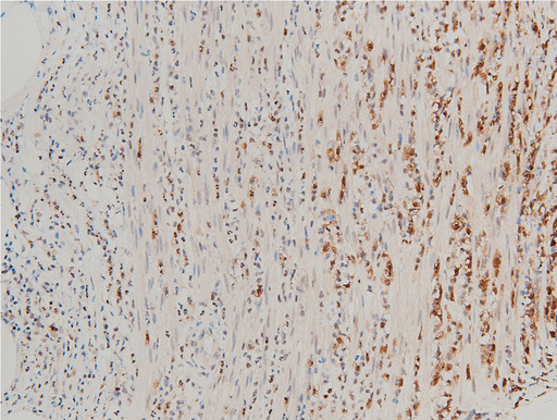 CFL1 / Cofilin Antibody - 1:100 staining rat appendix tissue by IHC-P. The tissue was formaldehyde fixed and a heat mediated antigen retrieval step in citrate buffer was performed. The tissue was then blocked and incubated with the antibody for 1.5 hours at 22°C. An HRP conjugated goat anti-rabbit antibody was used as the secondary.