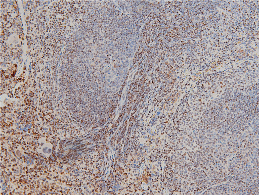 CFL1 / Cofilin Antibody - 1:100 staining mouse spleen tissue by IHC-P. The tissue was formaldehyde fixed and a heat mediated antigen retrieval step in citrate buffer was performed. The tissue was then blocked and incubated with the antibody for 1.5 hours at 22°C. An HRP conjugated goat anti-rabbit antibody was used as the secondary.