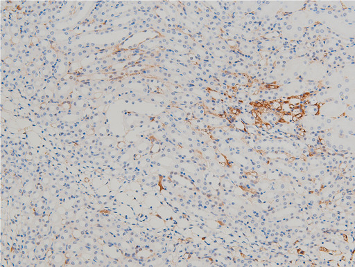 CFL1 / Cofilin Antibody - 1:100 staining mouse kidney tissue by IHC-P. The tissue was formaldehyde fixed and a heat mediated antigen retrieval step in citrate buffer was performed. The tissue was then blocked and incubated with the antibody for 1.5 hours at 22°C. An HRP conjugated goat anti-rabbit antibody was used as the secondary.