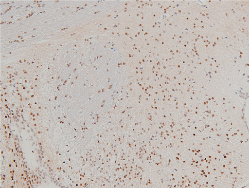 CFL1 / Cofilin Antibody - 1:100 staining mouse brain tissue by IHC-P. The tissue was formaldehyde fixed and a heat mediated antigen retrieval step in citrate buffer was performed. The tissue was then blocked and incubated with the antibody for 1.5 hours at 22°C. An HRP conjugated goat anti-rabbit antibody was used as the secondary.