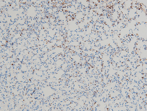 CFL1 / Cofilin Antibody - 1:100 staining mouse lung tissue by IHC-P. The tissue was formaldehyde fixed and a heat mediated antigen retrieval step in citrate buffer was performed. The tissue was then blocked and incubated with the antibody for 1.5 hours at 22°C. An HRP conjugated goat anti-rabbit antibody was used as the secondary.