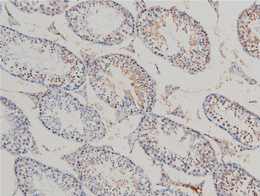 CFL1 / Cofilin Antibody - 1:100 staining mouse testis tissue by IHC-P. The tissue was formaldehyde fixed and a heat mediated antigen retrieval step in citrate buffer was performed. The tissue was then blocked and incubated with the antibody for 1.5 hours at 22°C. An HRP conjugated goat anti-rabbit antibody was used as the secondary.
