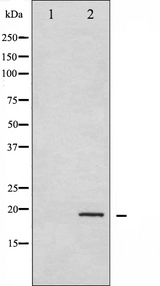 CFL1 / Cofilin Antibody - Western blot analysis of Cofilin phosphorylation expression in COLO205 whole cells lysates. The lane on the left is treated with the antigen-specific peptide.