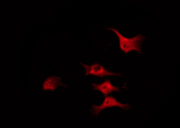 CFL1 / Cofilin Antibody - Staining COLO205 cells by IF/ICC. The samples were fixed with PFA and permeabilized in 0.1% Triton X-100, then blocked in 10% serum for 45 min at 25°C. The primary antibody was diluted at 1:200 and incubated with the sample for 1 hour at 37°C. An Alexa Fluor 594 conjugated goat anti-rabbit IgG (H+L) Ab, diluted at 1/600, was used as the secondary antibody.