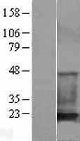 CFL1 / Cofilin Protein - Western validation with an anti-DDK antibody * L: Control HEK293 lysate R: Over-expression lysate