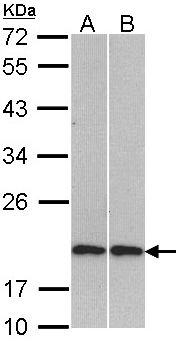 CFL2 / Cofilin 2 Antibody - Sample (30 ug of whole cell lysate). A: H1299, B: Molt-4 . 12% SDS PAGE. Cofilin 2 antibody diluted at 1:1000.