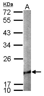 CFL2 / Cofilin 2 Antibody - Sample (50 ug of whole cell lysate). A: mouse brain. 12% SDS PAGE. Cofilin 2 antibody diluted at 1:1000.