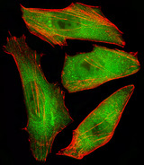 CFL2 / Cofilin 2 Antibody - Fluorescent image of HeLa cells stained with CFL2 Antibody. Antibody was diluted at 1:25 dilution. An Alexa Fluor 488-conjugated goat anti-rabbit lgG at 1:400 dilution was used as the secondary antibody (green). Cytoplasmic actin was counterstained with Alexa Fluor 555 conjugated with Phalloidin (red).