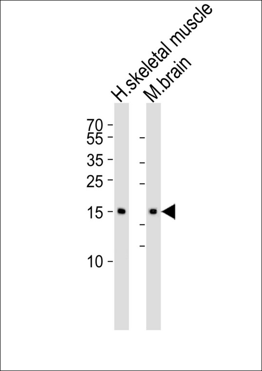 CFL2 / Cofilin 2 Antibody - Western blot of lysates from human skeletal muscle and mouse brain tissue lysate (from left to right) with CFL2 Antibody. Antibody was diluted at 1:1000 at each lane. A goat anti-rabbit IgG H&L (HRP) at 1:5000 dilution was used as the secondary antibody. Lysates at 35 ug per lane.