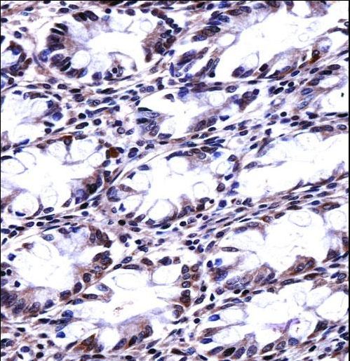 CFL2 / Cofilin 2 Antibody - CFL2 Antibody immunohistochemistry of formalin-fixed and paraffin-embedded human rectum tissue followed by peroxidase-conjugated secondary antibody and DAB staining.