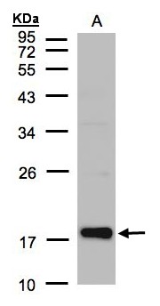 CFL2 / Cofilin 2 Antibody - Sample (30 ug of whole cell lysate). A: Raji . 12% SDS PAGE. Cofilin 2 antibody diluted at 1:1000