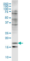 CFL2 / Cofilin 2 Antibody - CFL2 monoclonal antibody (M03), clone 6G9 Western blot of CFL2 expression in HeLa.