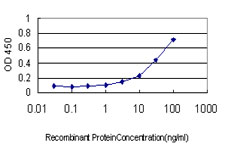 CFL2 / Cofilin 2 Antibody - Detection limit for recombinant GST tagged CFL2 is approximately 1 ng/ml as a capture antibody.