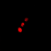 CFL2 / Cofilin 2 Antibody - Immunofluorescent analysis of Cofilin 2 staining in A549 cells. Formalin-fixed cells were permeabilized with 0.1% Triton X-100 in TBS for 5-10 minutes and blocked with 3% BSA-PBS for 30 minutes at room temperature. Cells were probed with the primary antibody in 3% BSA-PBS and incubated overnight at 4 deg C in a humidified chamber. Cells were washed with PBST and incubated with a DyLight 594-conjugated secondary antibody (red) in PBS at room temperature in the dark.