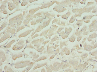 CFL2 / Cofilin 2 Antibody - Immunohistochemistry of paraffin-embedded human heart tissue at dilution 1:100