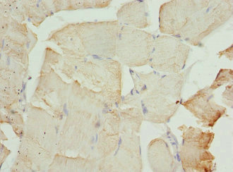 CFL2 / Cofilin 2 Antibody - Immunohistochemistry of paraffin-embedded human skeletal muscle tissue at dilution 1:100