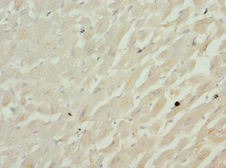 CFL2 / Cofilin 2 Antibody - Immunohistochemistry of paraffin-embedded human heart tissue at dilution 1:100