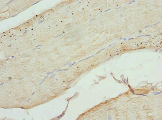 CFL2 / Cofilin 2 Antibody - Immunohistochemistry of paraffin-embedded human skeletal muscle tissue at dilution 1:100