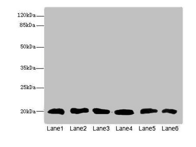 CFL2 / Cofilin 2 Antibody - Western blot All Lanes: CFL2 antibody at 3.75ug/ml Lane 1: Mouse brain tissue Lane 2: Mouse liver tissue Lane 3: Mouse lung tissue Lane 4: LO2 whole cell lysate Lane 5: Hela whole cell lysate Lane 6: A549 whole cell lysate Goat polyclonal to Rabbit IgG at 1/10000 dilution Predicted band size: 19,17 kDa Observed band size: 19 kDa